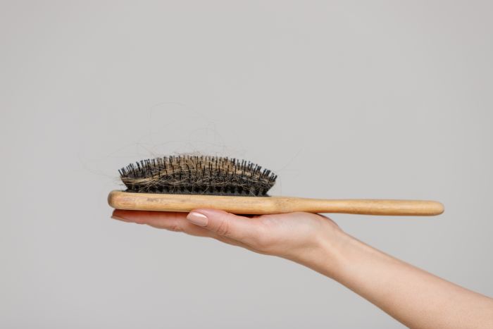 Hair Loss Problem Close Up Woman Hand Holding Comb Brush With Lost Hair Side View
